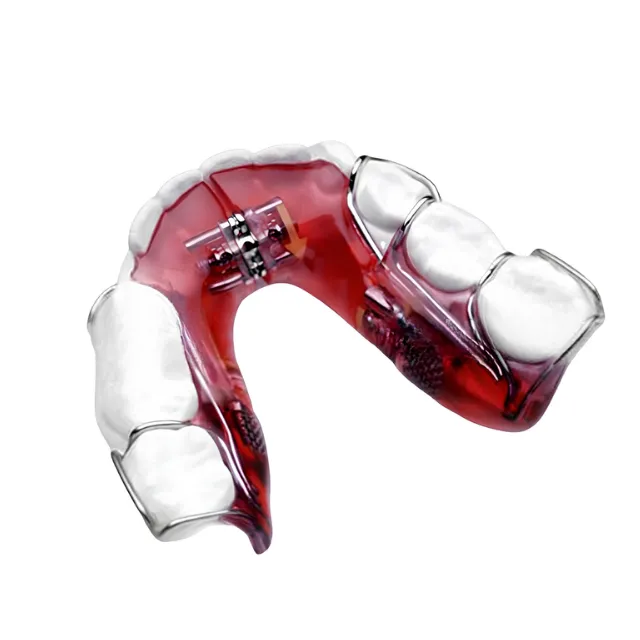 American Orthodontics Medium Expansion Screw - 5 Adet photo