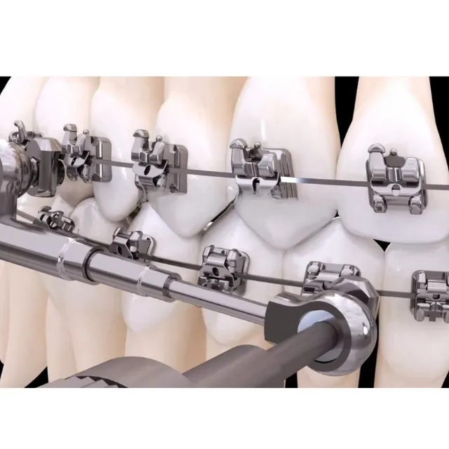 American Orthodontics Power Scope 5 Hastalık Kit photo