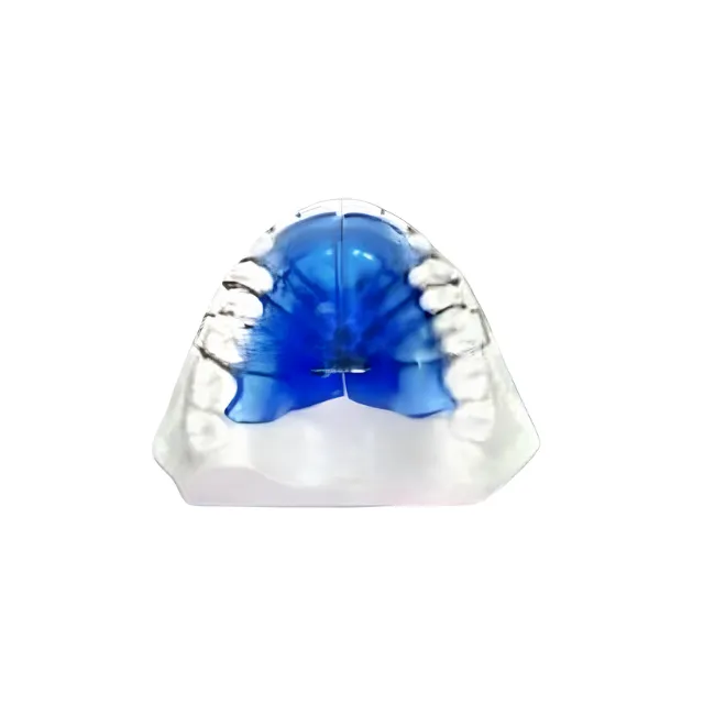 American Orthodontics Standart Expansion Screw - 5 Adet photo