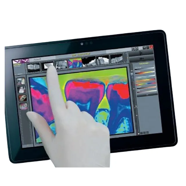 Bluemax Maxiray 2 Usb Rvg Tablet ve Pc'de Çalışır photo