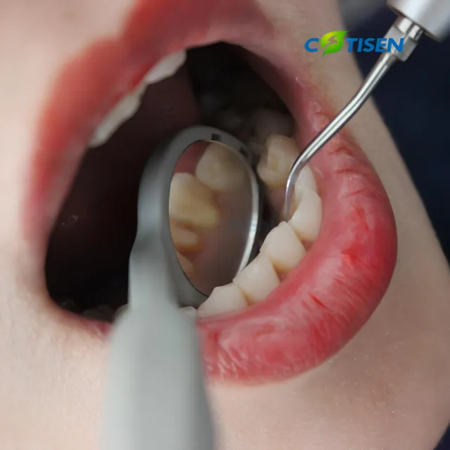 Cotisen AeroView Aspirasyonlu Tedavi Aynası (50 Adet) 3