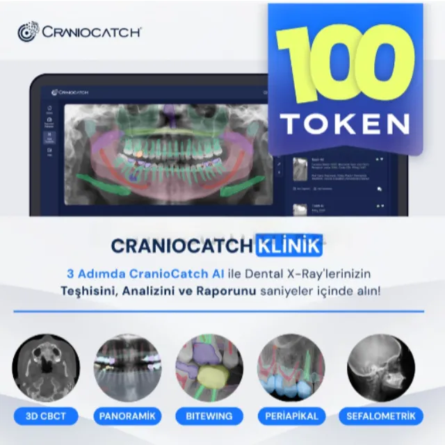 CranioCatch AI ile Dental X-Ray İçin Teşhis, Analiz ve Rapor - 100 Token photo
