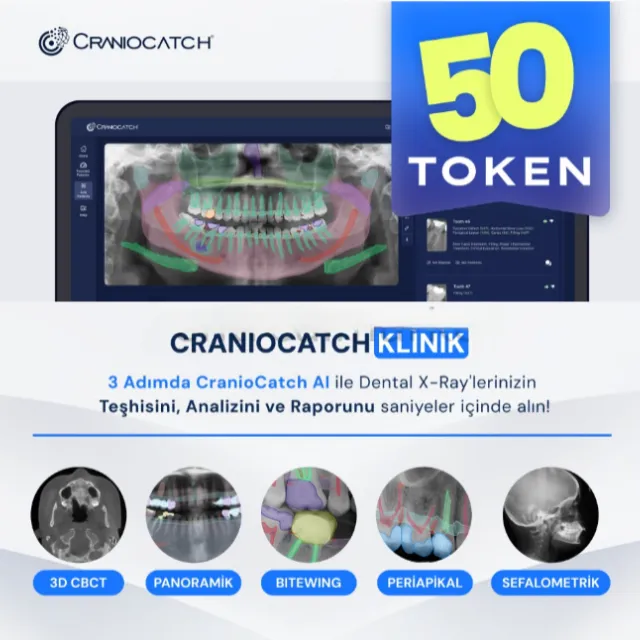 CranioCatch AI ile Dental X-Ray İçin Teşhis, Analiz ve Rapor - 50 Token photo