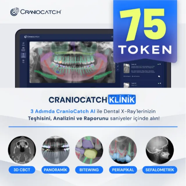 CranioCatch AI ile Dental X-Ray İçin Teşhis, Analiz ve Rapor - 75 Token photo