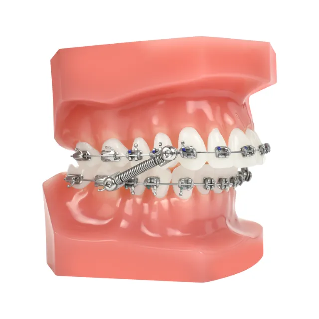 Dynaflex CS5 Class II & Class III Corrector with Traditional Pivot - 5 Patient Kit photo