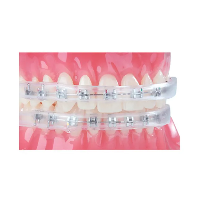 Dynaflex Ortho- LipGuard Braket Koruyucu photo