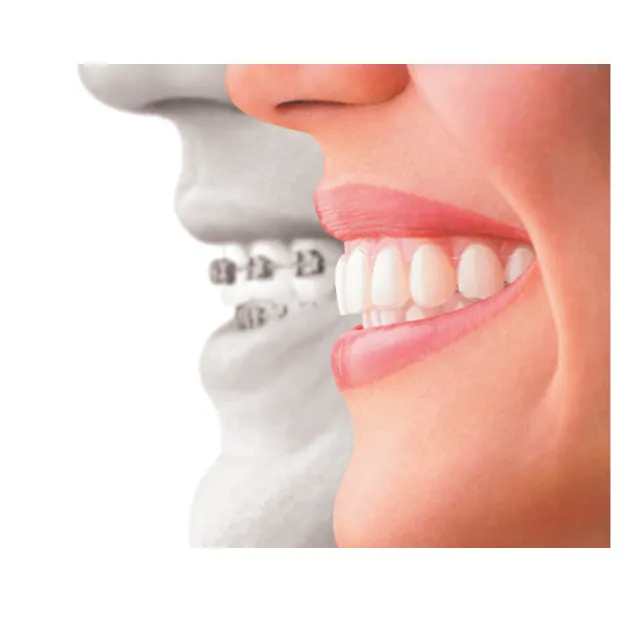 Dynaflex Orthodonti Profesyonel İntro Set photo