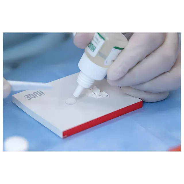 Huge Filling I Cam İyonomer Dolgu 2