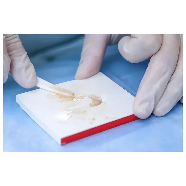 Huge Filling I Cam İyonomer Dolgu 3
