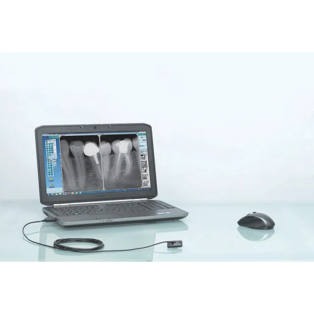 Owandy One İntraoral X-Ray Sensörü RVG Size 1 4