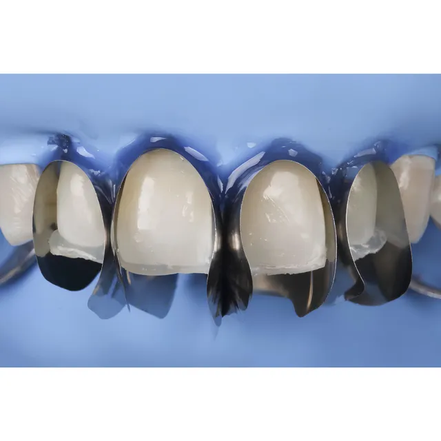 Polydentia Unica Minideep Anterior Matris 50 adet refil 3