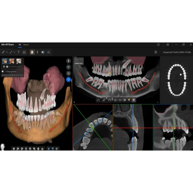 Ray SmartDent 20x20  photo