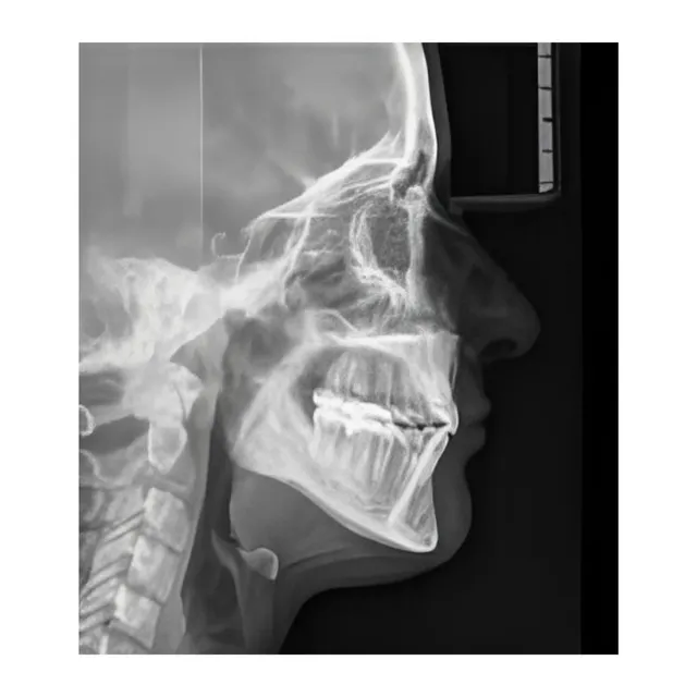 Sirona Orthophos E Ceph Panoramik ve Sefalometrik Röntgen Cihazı 3