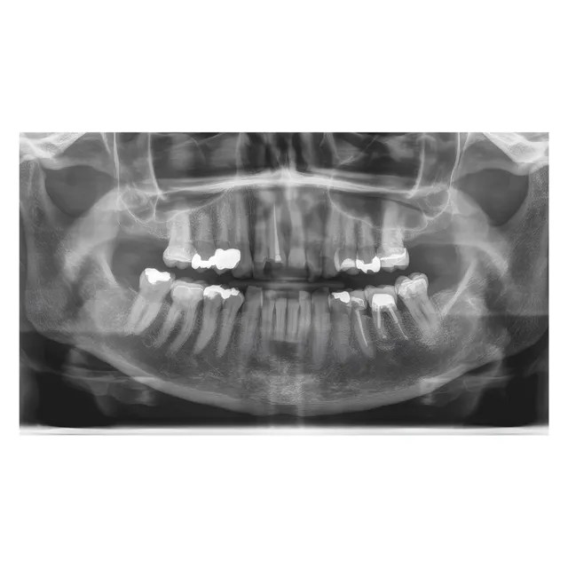 Sirona Orthophos E Panoramik Röntgen Cihazı 3