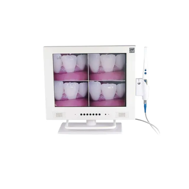 TCF Kamera + 15" Monitor Seti photo