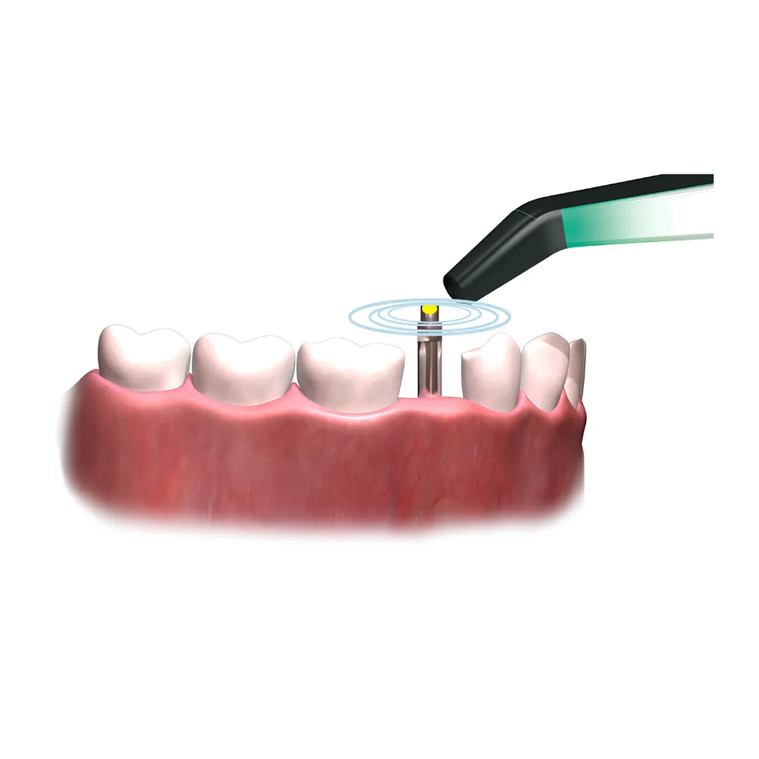 W&H Osstell Beacon İmplant Stabilite Ölçüm Cihazı 3